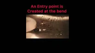 Modified Tube Technique For Broken instrument Retrieval