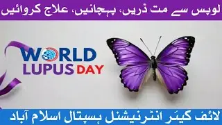 Lupus Explained: Early Signs, Symptoms & Hopeful Treatments | Life Care International Hospital