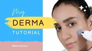 My DermaSuction Experience | Pore Cleaning Device  | Iknoor Somal