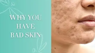 Why You Have Bad Skin And How to Fix It | Traditional Chinese Medicine