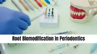Root Biomodification in Periodontics || Mind Musings #dental #dentistry