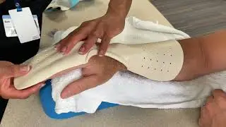 Dorsal block