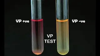 Voges Proskauer Test