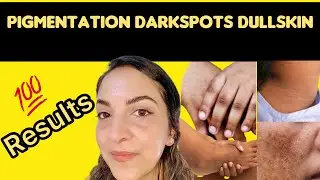 Pigmentation Darkspots just apply this pack and see the visible difference with one apply😲