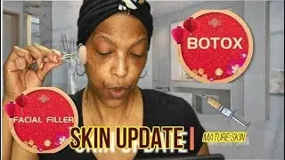 Skin Care Update | ?? Botox and Facial Filler ?? | WOC | Mature Skin