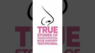 Nose surgery in Bangalore |Patient Experience #rhinoplasty #nosereshape #nosefiller #plasticsurgeon