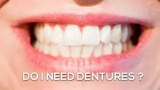 Dentures Kansas City  | Prosthodontist 913 631 2677
