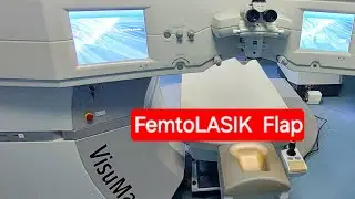 فيديو مهم عن فلاب الفيمتوليزيك والأجهزة المختلفة Alcon Ex500  و جهاز Zeiss Visumax.
