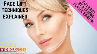 Different techniques of facelift explained by Dr. Edmund Kwan