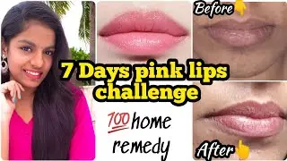 7 days PINK LIPS challenge 🤩Home remedy for dark lips & pigmented lips💯 natural #pinklips
