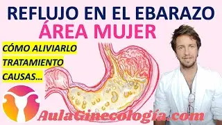 REFLUJO y EMBARAZO. CÓMO ALIVIARLO, TRATAMIENTO, CAUSAS... Ginecología y Obstetricia