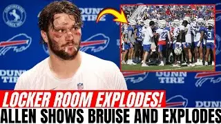 HE WAS COWARDLY! Josh Allen Arrives With Facial Bruise and EXPLODES | Buffalo Bills News Today