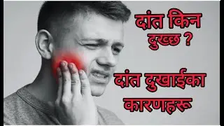 TOOTH PAIN.दांत किन दुख्छ ? दांत दुखाईका कारणहरू:- HAMRO DENTAL