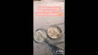 Saline Implants vs Gummy Bear Implants | Evoclinic