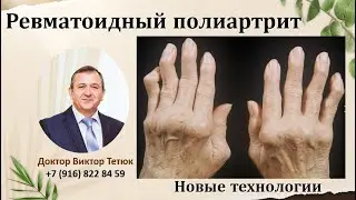 Как вылечить ревматоидный полиартрит.  Виктор Тетюк новые технологи.