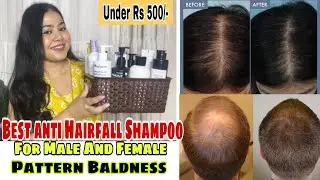 5 Best Anti Hair Loss Shampoo For Female and Male Pattern Baldness| Amazon Beauty Haul #antihairfall