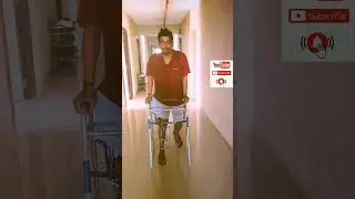 ACCIDENT🧑&zwj;🦯FRACTURE LEG BROKENLEG #recovery #tibia #femur #patela #knee  #trendingshorts #youtube