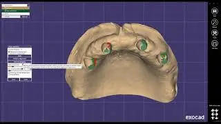 Exocad PIC dental integration