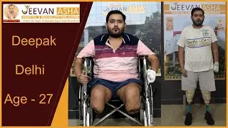 JAHRC provided him free of cost Modular prosthesis and now he can walk and work for his livelihood