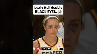 🤕 Lexie Hull has 2 BLACK EYES! Indiana Fever WNBA womens basketball #shorts #short #basketball #wnba