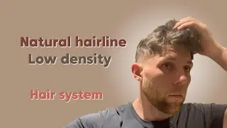 Mars: Worth Buying? (Watch Before You Buy!) | LaVivid Hair System