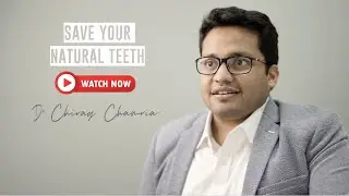 Watch This and Save Your Natural Teeth | Dental Insights by Dr Chirag Chamria | Oral Surgeon
