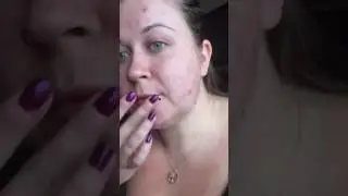 Wrinkles away & secret illuminator