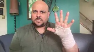 Post Carpal Tunnel Release Surgery vlog installment 2 - Bandage Removal Mandolin Violin Musician