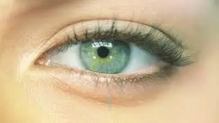Onefit MED / MED Plus Advanced Scleral Lenses
