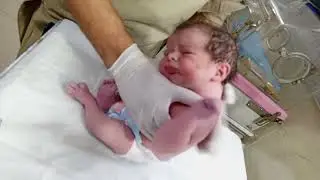 newborn care first assessment, Inj. K-Lot (Vitamin K), oral care, and NICU practices