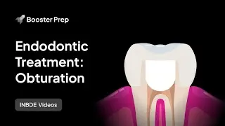 Endodontics | Treatment - Obturation | INBDE, NDEB, ADAT