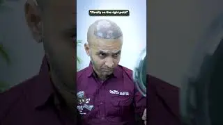 Previous transplant didn't give the result | Latest Fue Technique #shorts #viral #hair