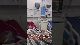 ventilator patient suffering from the copd ##motivation ##medicalstudent #knowledge #hospital
