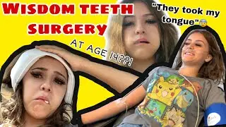 getting my wisdom teeth removed at 14 (part 1)
