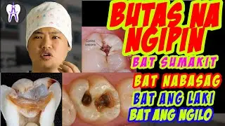Paano Lumaki Ang Sira ng Ngipin.. At Mga Dapat Malaman Tunkol Dito(English subtitle) #48