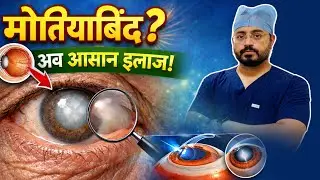 Advanced Diagnosis & Cataract Surgeries at Anantwar Eye Hospital | Consult Dr. Pankaj Anantwar