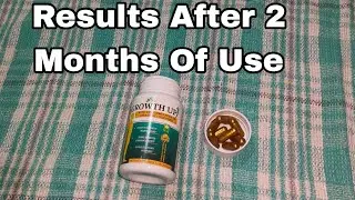 Divya Shakti Growth Up Height Increase Tablets Results After 2 Months of Uses