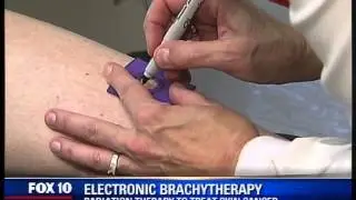 Fox 10 Interview discussing Skin Cancer treatment with Phoenix Dermatologist Dr. Nancy Kim