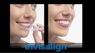 Invisalign Clear Braces in Oakland, NJ
