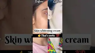 skin whitening cream |  skin light cream |