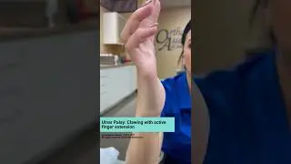 Example of ulnar palsy patient with a claw deformity with PIP joint contracture