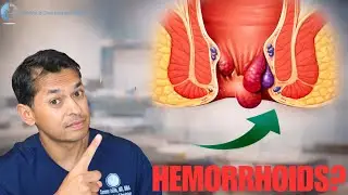 Hemorrhoids Explained: Symptoms, Causes, & When  to See a GI Doctor in Lubbock