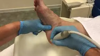 Basis pedicure behandeling - voeten met eelt en likdoorns en teennagels verzorgen