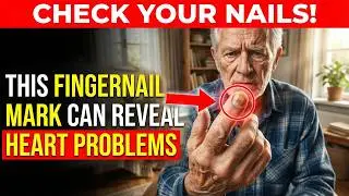 Seniors, Your Fingernails Reveal Hidden Heart Problems &mdash; Watch for These Marks
