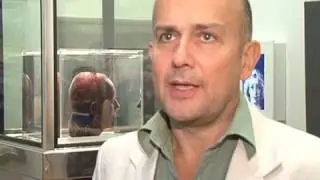 A frozen head made of blood goes on display