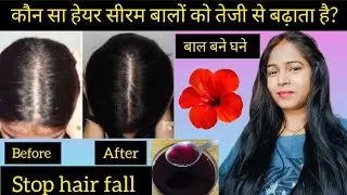 💞 hair serum for hair growth। hibiscus hair serum#hibiscus#naturallyrina