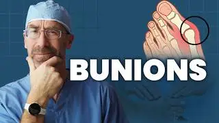 What Is a Bunion—and What Can You Do About It?