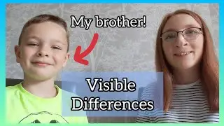 Talking To My 7 Year Old Brother About Visible Differences