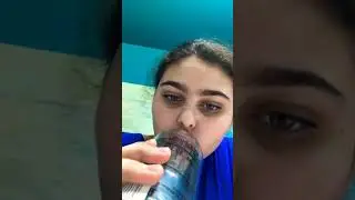 KYLIE JENNER LIP CHALLENGE *GONE WRONG*