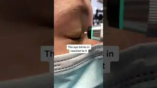 Eye pressure test slow motion